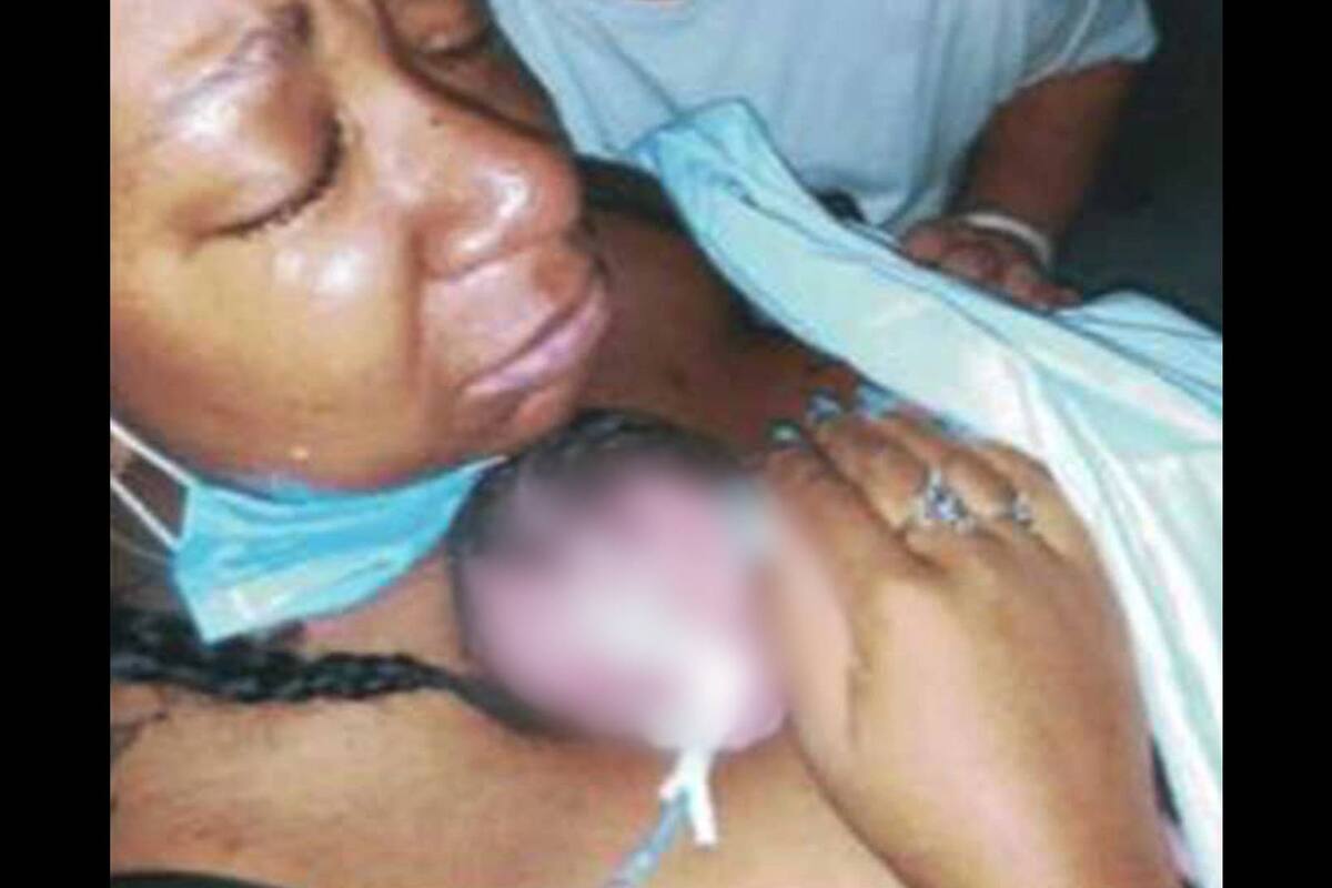 EU: Tras dos abortos, da a luz a hija prematura y "la pierden entre sábanas"