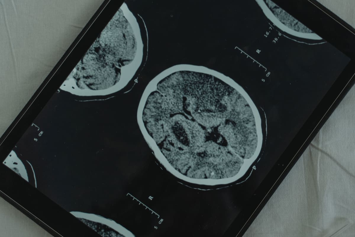 ¿Tu cerebro funciona mejor que el de otras personas? La ciencia dice que tus surcos cerebrales podrían ser la clave