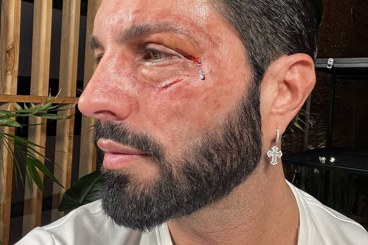 Aparece Poncho de Nigris aparentemente "golpeado" en redes sociales