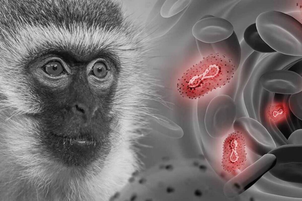 Se reportan dos mil 468 casos de viruela símica en México