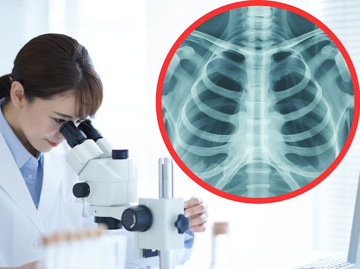 Científicos crean una forma automática de fabricar mini pulmones en laboratorio