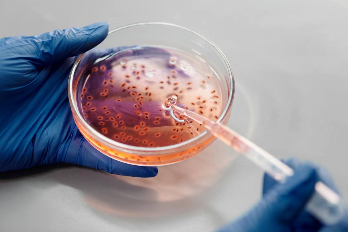 EU: CDC investigan brote de infecciones por Listeria en 12 estados; van dos muertes