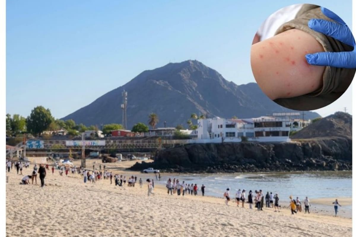 Descartan repunte de sarampión en BC durante Semana Santa