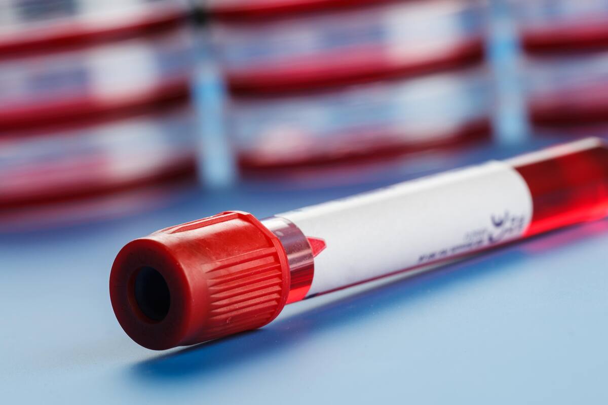 Descubren nueva forma de biopsia