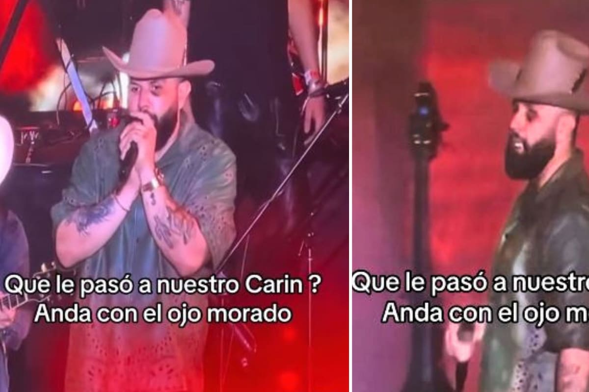 Carin León sorprende al aparecer con un ojo morado en concierto