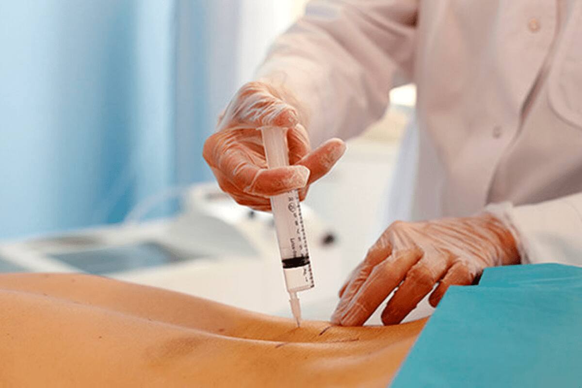Político sugiere administrar ozono por vía rectal contra el covid-19