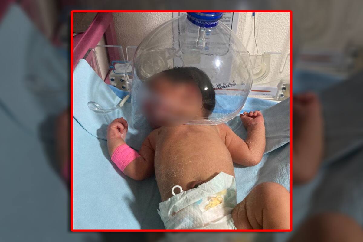 Ante falta de insumos médicos, colocan botella de plástico a recién nacido en hospital IMSS-Bienestar de Tabasco