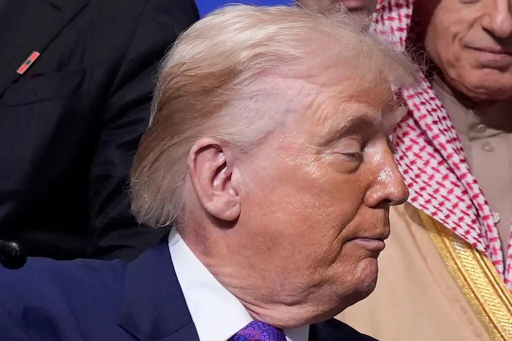 La marca en el cuello de Donald Trump y sus “cankles”: qué explicó la Casa Blanca sobre su estado de salud. Foto: AP