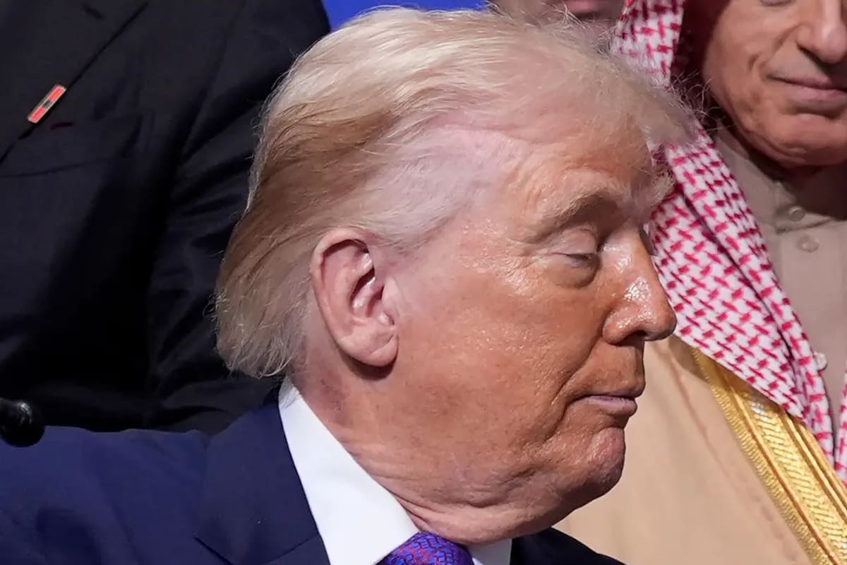 La marca en el cuello de Donald Trump y sus “cankles”: qué explicó la Casa Blanca sobre su estado de salud. Foto: AP