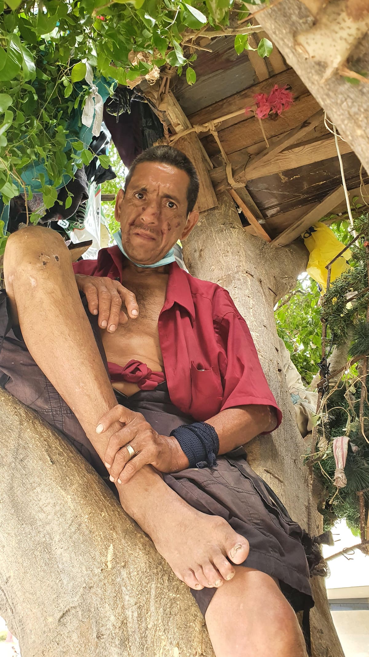Esteban García vive de lo que la gente le da, de lo que encuentra buscando en las sobras de los hot dogs.