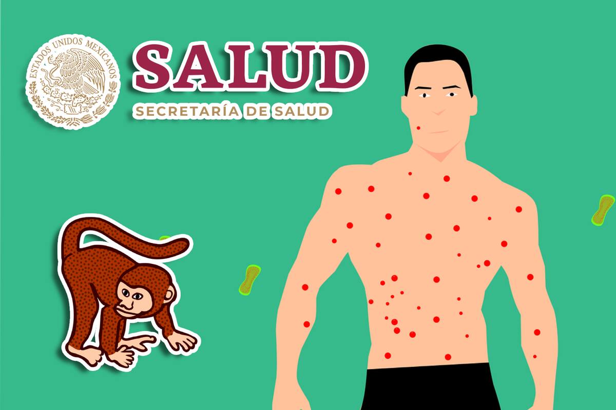 Mpox en México: Aumentan a 53 los casos confirmados en el país