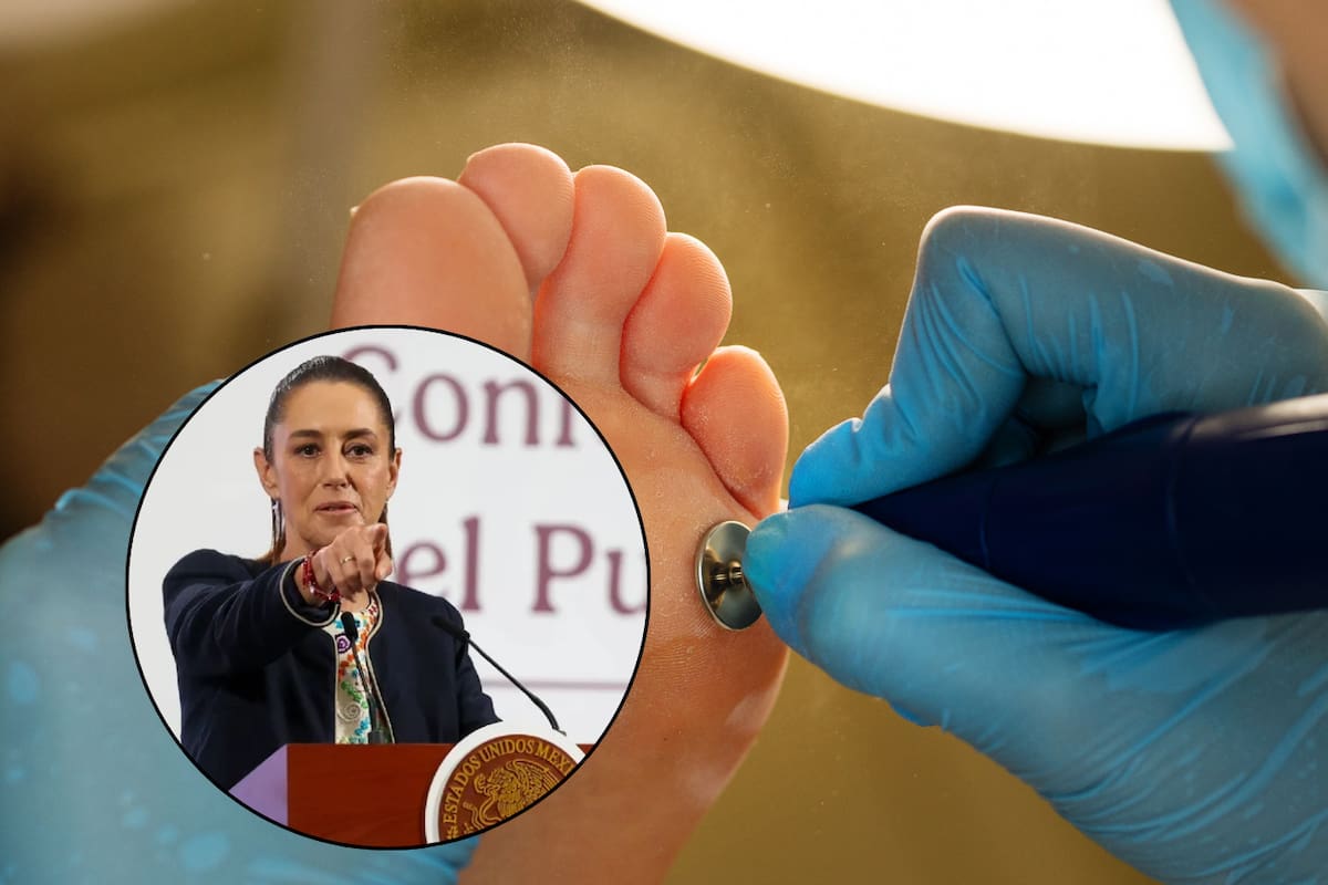 Claudia Sheinbaum confirma importación de tratamiento cubano para pie diabético