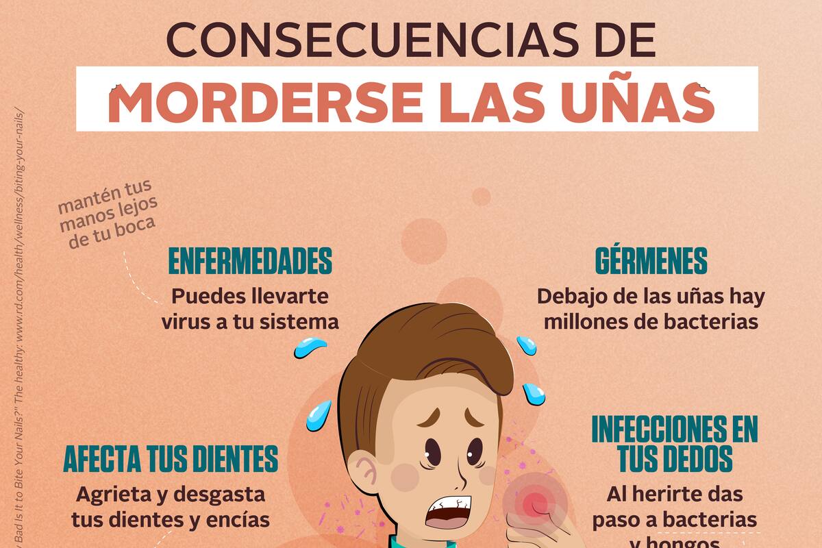 Consecuencias de morderse las uñas