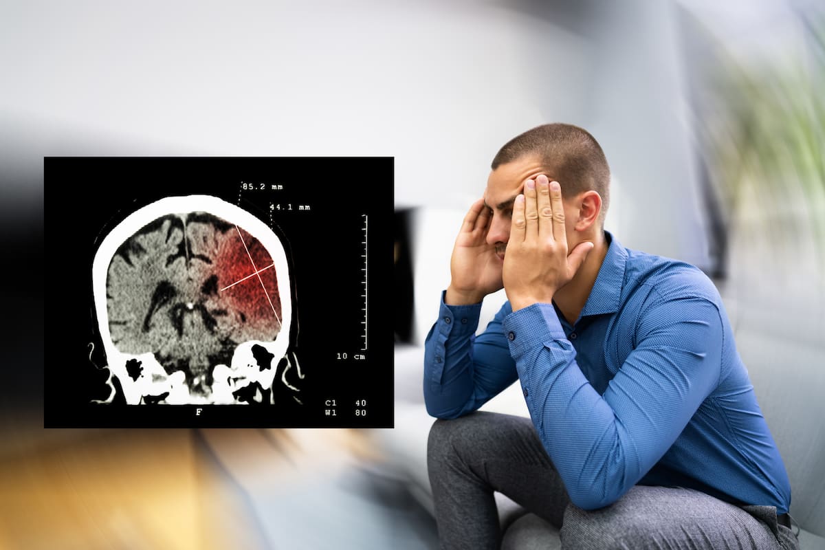¿Qué hacer ante un derrame cerebral? El método R.Á.P.I.D.O. permite reconocer síntomas repentinos y saber cuándo pedir ayuda médica, según los CDC