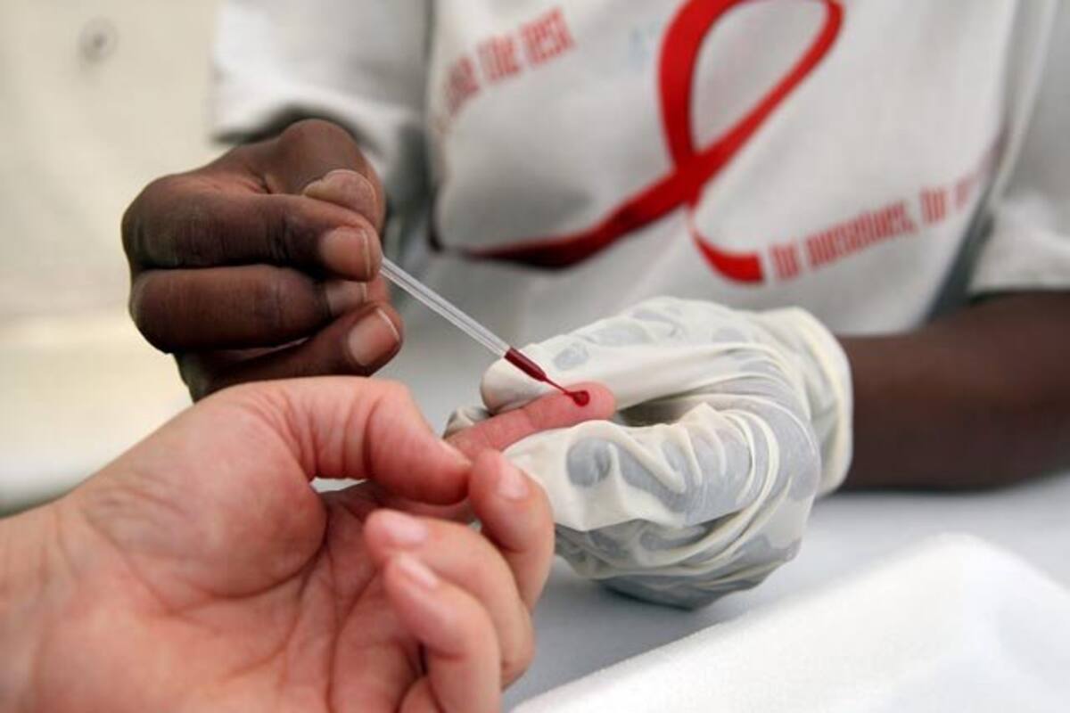 Mueren en Sonora 115 personas por sida en 2020