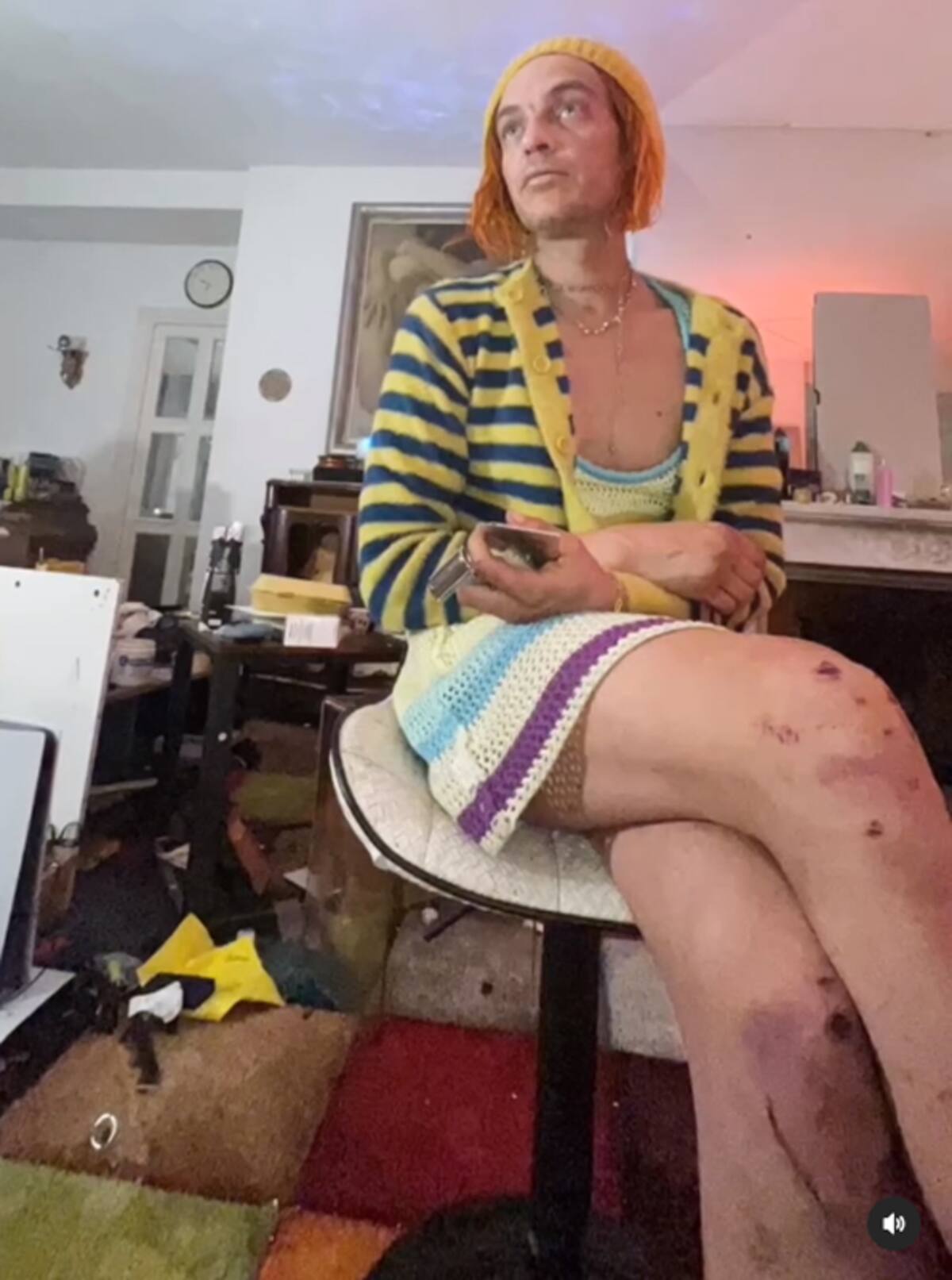 El artista muestra el impacto físico de lo que ha sido su vida durante 2024.