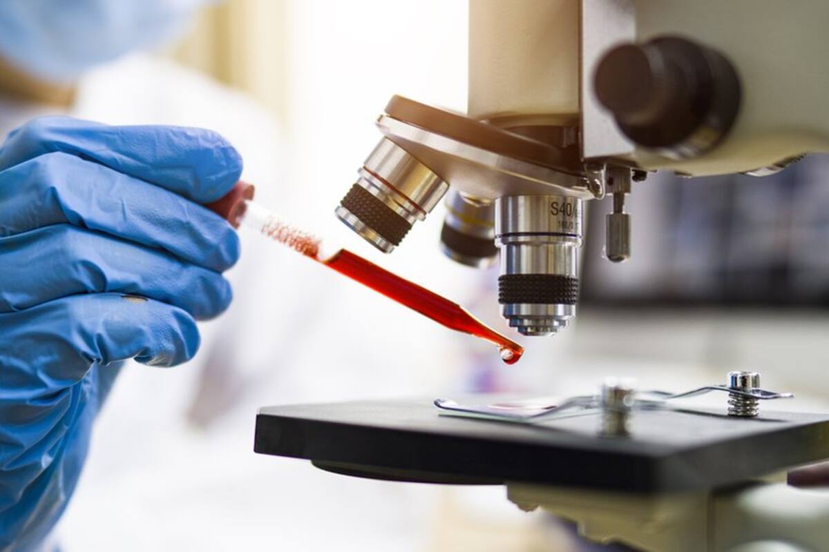 Coronavirus: cómo la tecnología ARNm puede abrir las puertas a una vacuna contra el cáncer