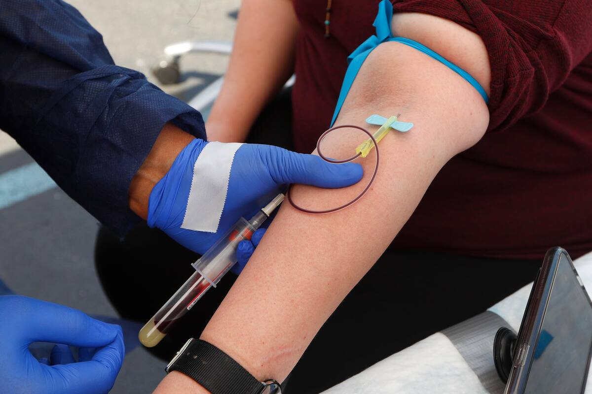 Aunque no tiene cura, la hemocromatosis puede manejarse con tratamientos como la flebotomía o la terapia de quelación. (AP Foto/Paul Sancya)