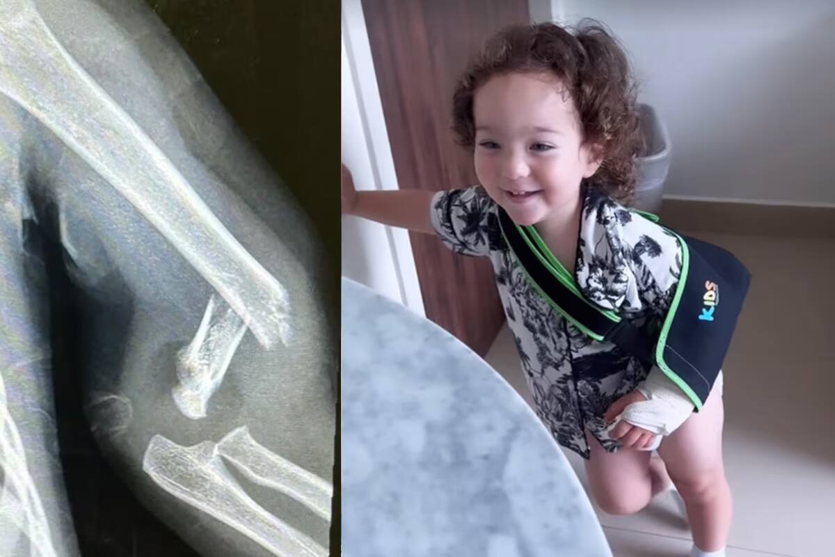Toñito, hijo de Poncho de Nigris, regresa a casa tras cirugía de emergencia