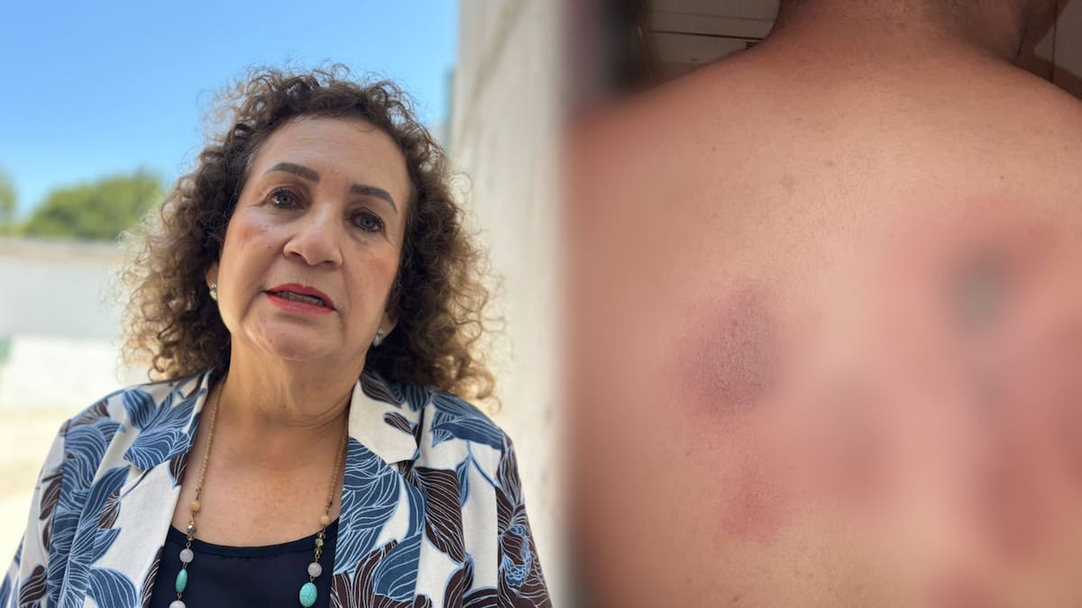 Lamenta Secretaría de Educación de Baja California caso de estudiante que fue quemado con sosa cáustica en secundaria de Tijuana