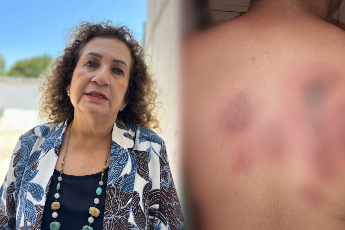 Lamenta secretaría de educación de Baja California caso de estudiante que fue quemado con sosa cáustica en secundaria de Tijuana