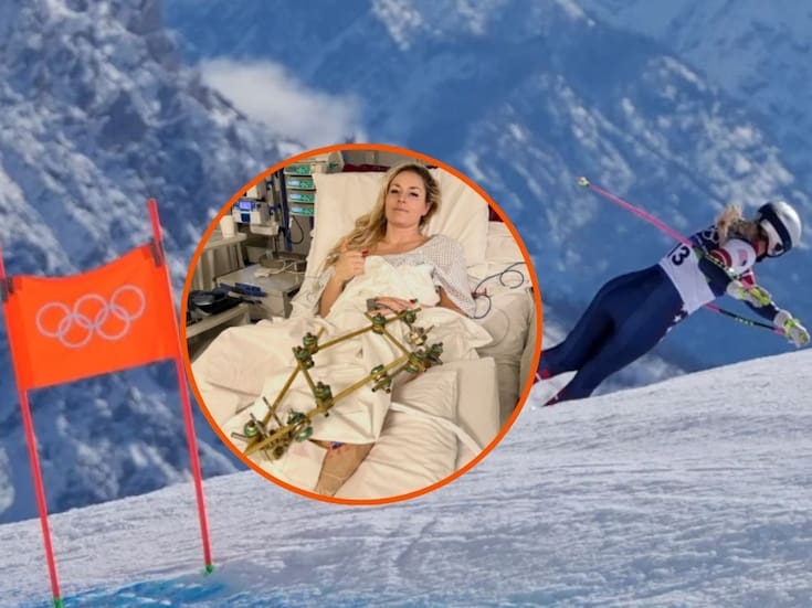 Lindsey Vonn sigue hospitalizada tras fuerte caída en descenso olímpico y confirma tercera cirugía por fractura de tibia