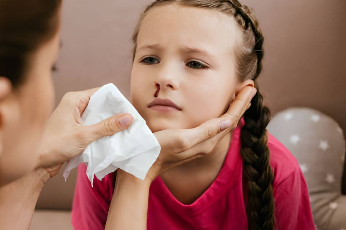 ¿Cuáles son las causas del sangrado nasal en niños?