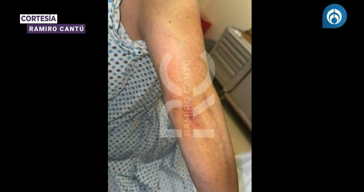 Presunta agresión de Alicia Villarreal a manos de Cruz Martínez