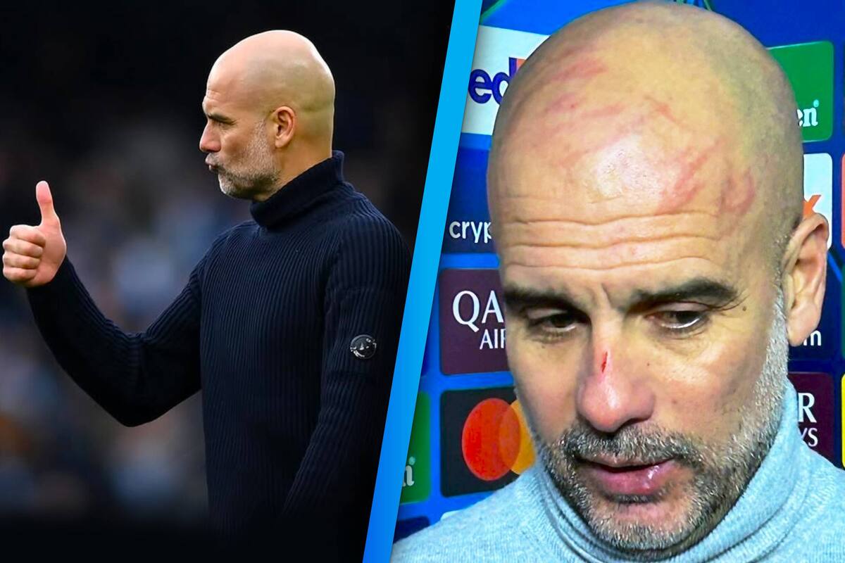 Pep Guardiola emitió un comunicado sobre la salud mental tras aclarar su respuesta respecto a las heridas en su cabeza. (Foto: @premierleague / Captura de pantalla)