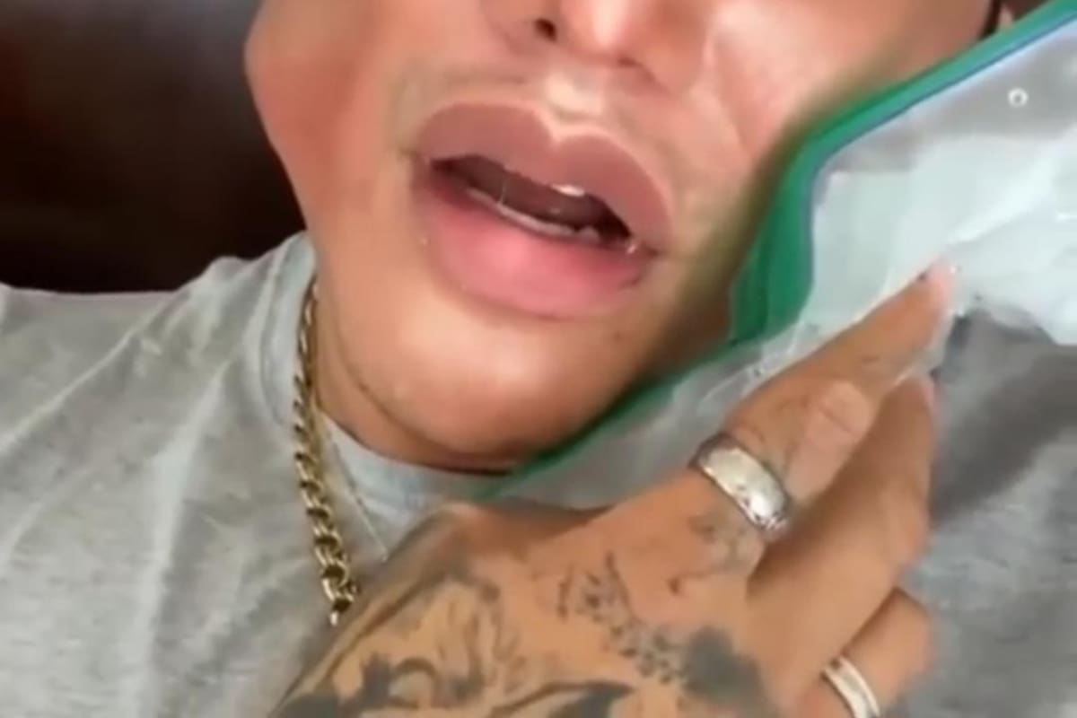 ¿Edwin Luna se hizo cirugía en el rostro?