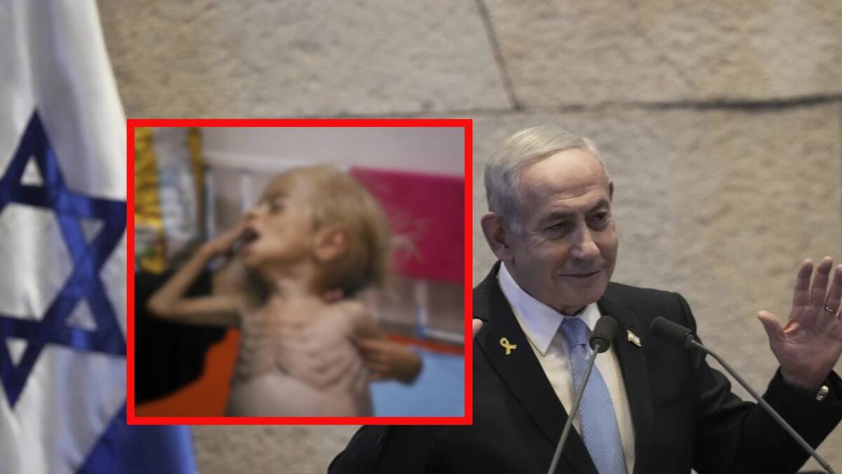 La crisis de desnutrición en Gaza acaba con los niños palestinos: La tragedia que Netanyahu niega y acusa de “mentiras” (IMÁGENES FUERTES)