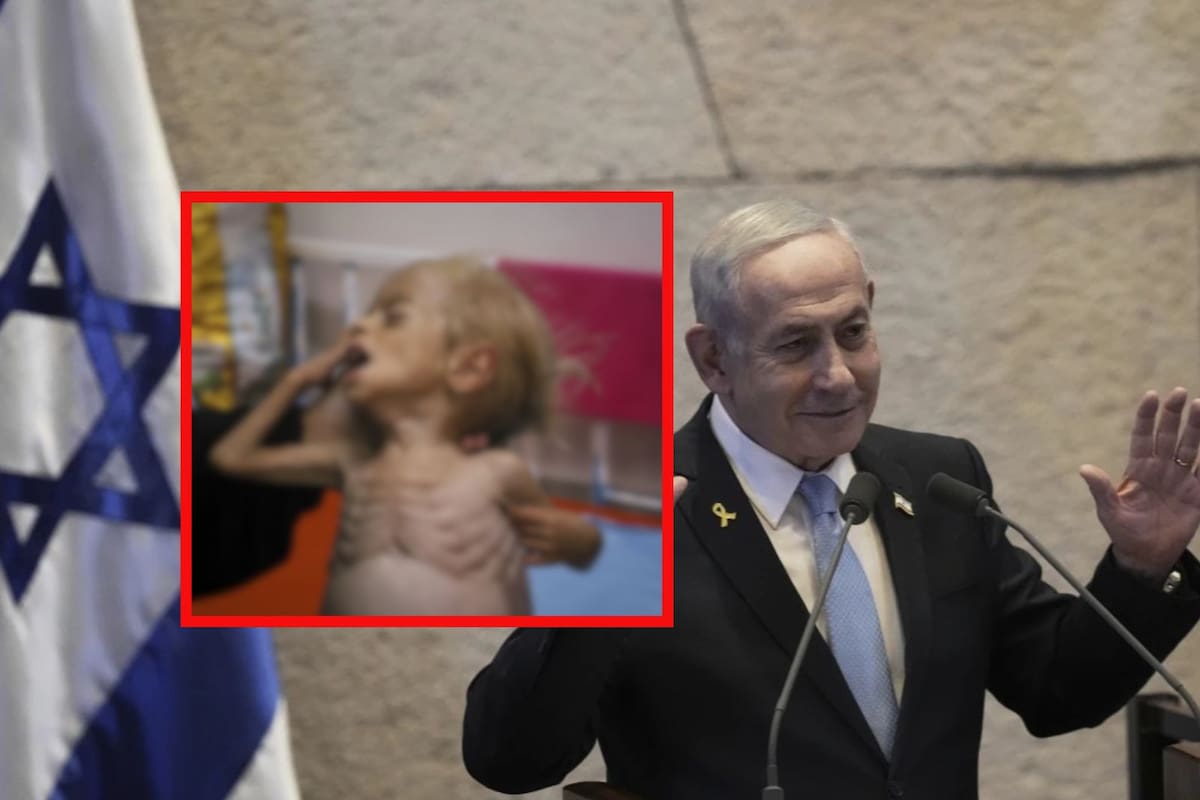 La crisis de desnutrición en Gaza acaba con los niños palestinos: La tragedia que Netanyahu niega y acusa de “mentiras” (IMÁGENES FUERTES)