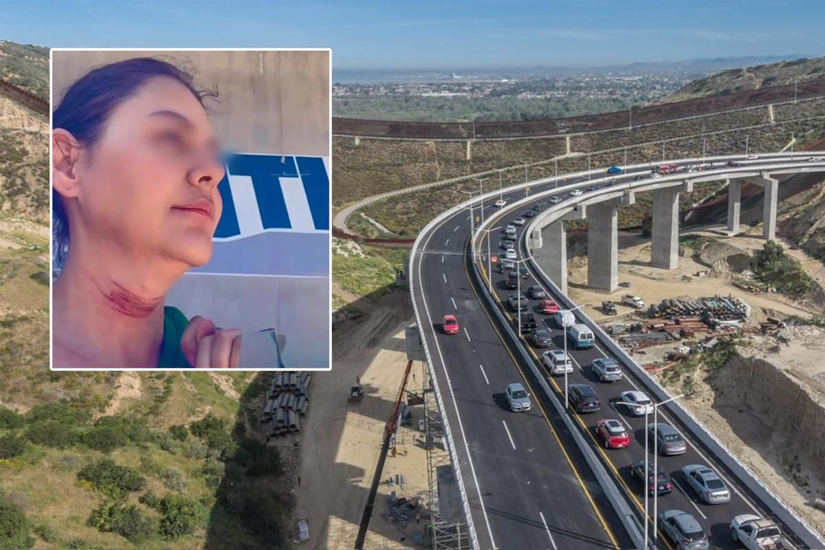 “Me arruinó la vida”: mujer de Tijuana denunció en redes las consecuencias de una cirugía plástica antes de morir