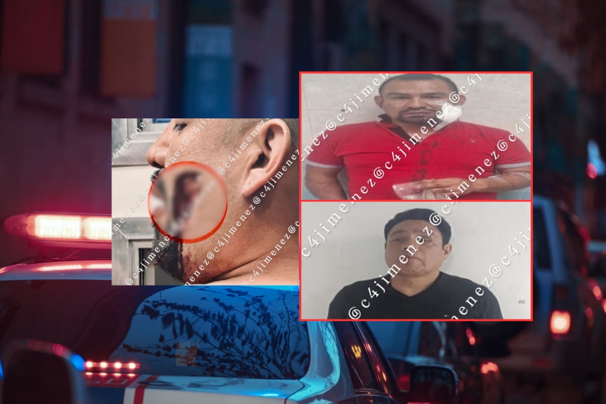 Hombre defiende a su prima de una agresión sexual en CDMX y termina detenido junto con el agresor, tras arrancarle de una mordida parte de la mejilla