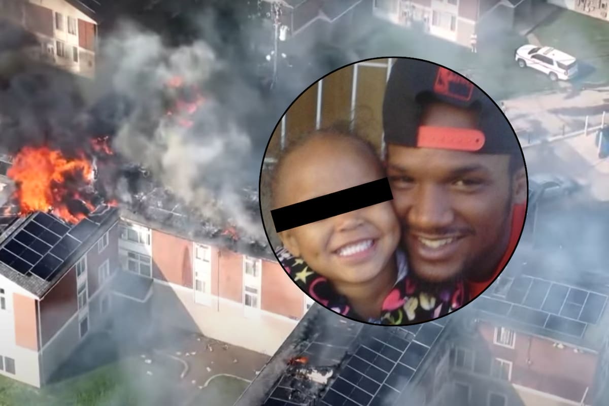 IMÁGENES FUERTES: Hombre se quema casi por completo al salvar a sus dos hijastros de un incendio