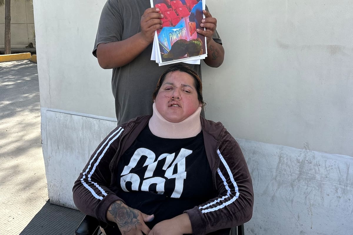 Pide justicia Blanca Elisa, quien resultó herida tras caerle una estructura en circo de Tijuana