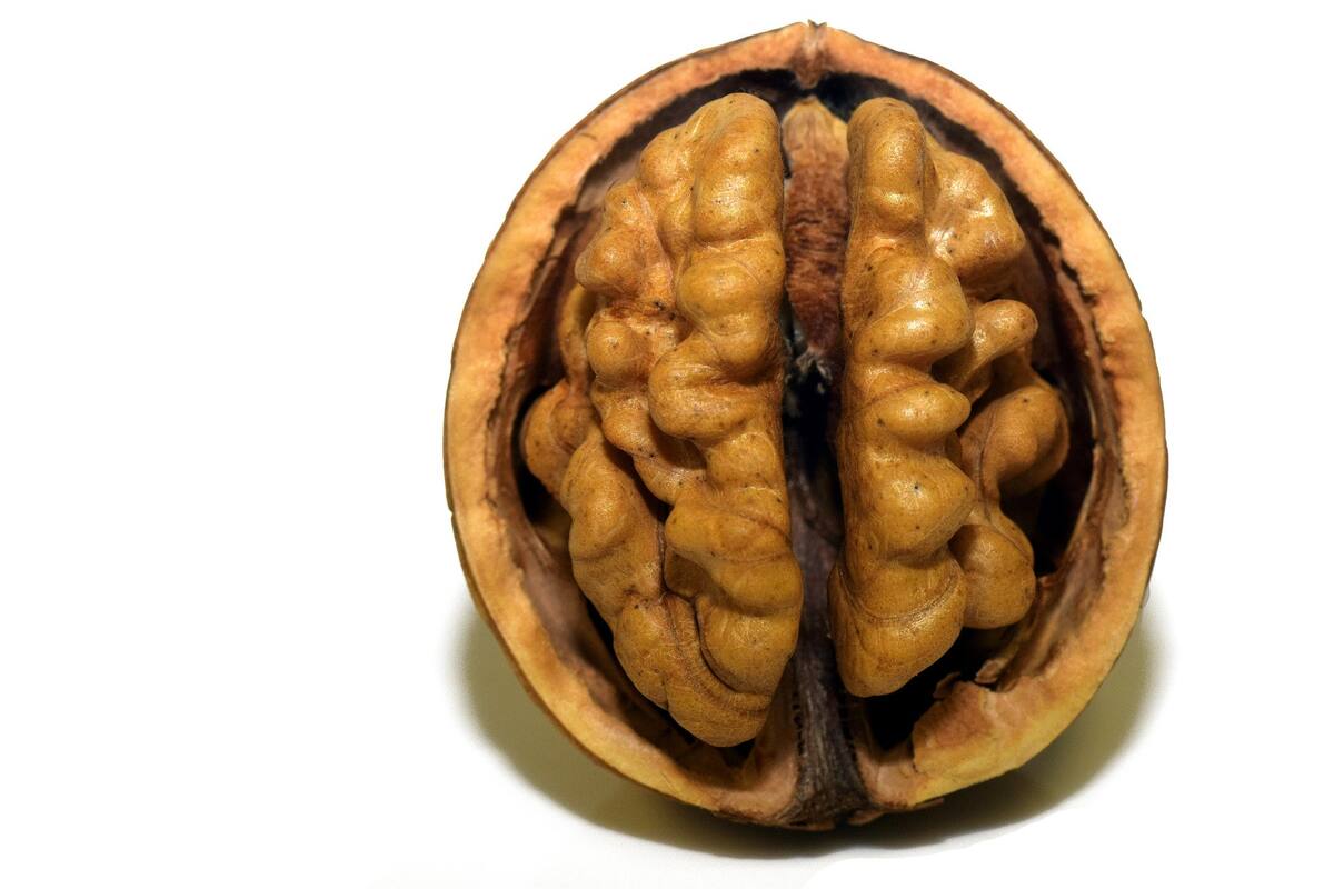 Alimentos que dañan tu cerebro