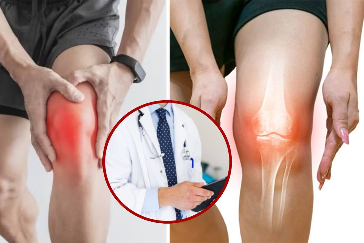 ¿Es normal que crujan las rodillas? Descubre cuándo preocuparte