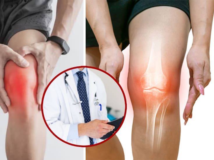 ¿Por qué duele la rodilla por las noches? Causas médicas más comunes, señales de alerta y cuándo acudir al doctor