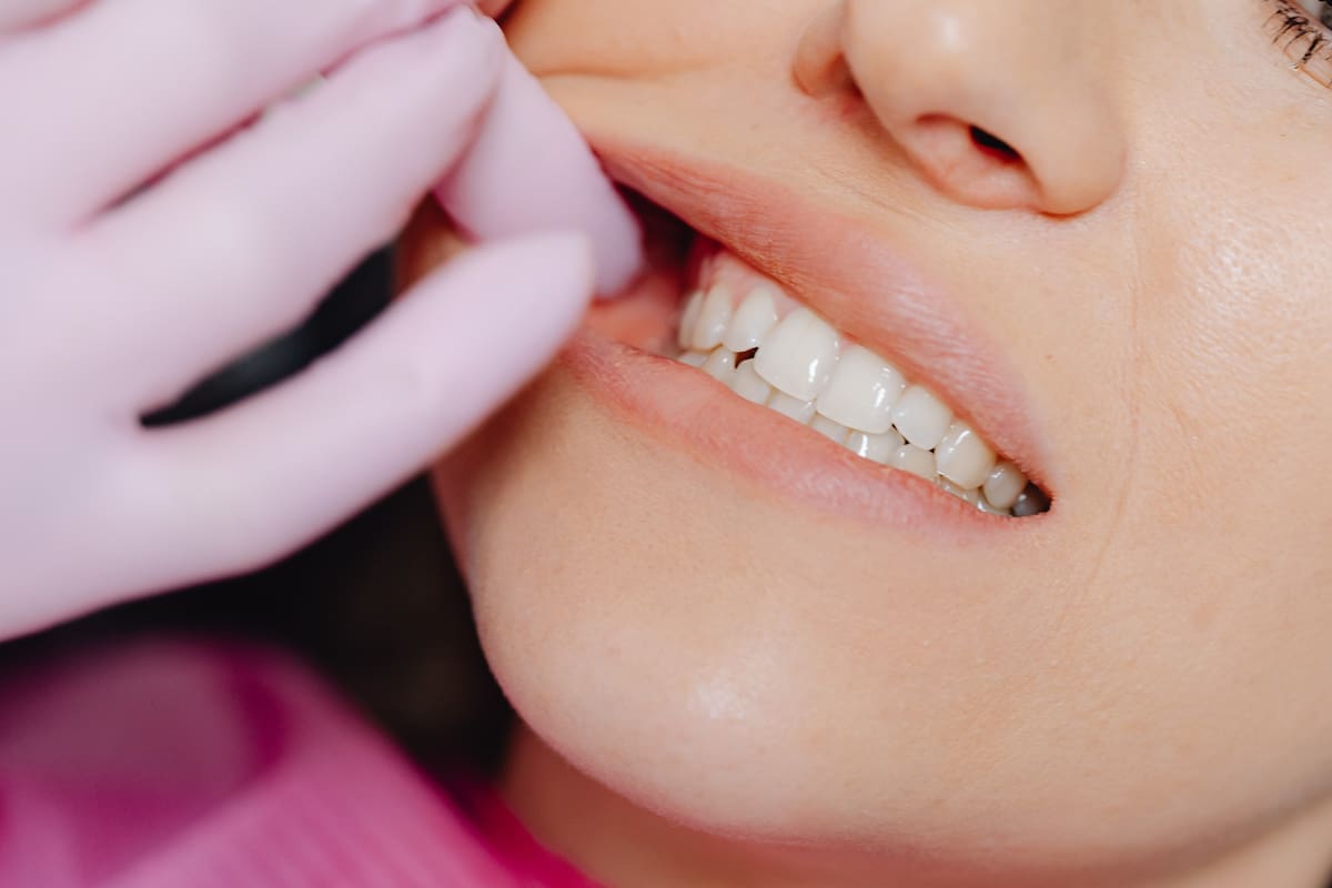 ¿Es necesario usar opioides después de extraer las muelas del juicio? Un estudio reciente sugiere que no