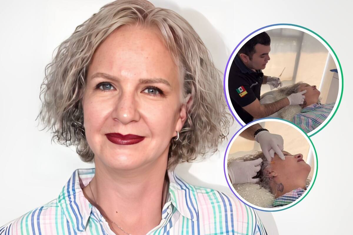 Acusan a Crista Montes de usar dinero de entrevista con Adrián Marcelo para pagar su tratamiento estético