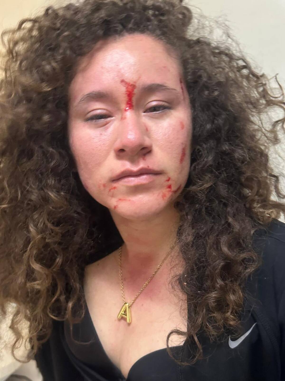 Así terminó la mujer identificada como Andrea Montserrat Ramos Gómez, tras ser agredida por la saxofonista y su hermana. | Crédito: X @PacoZeaCom