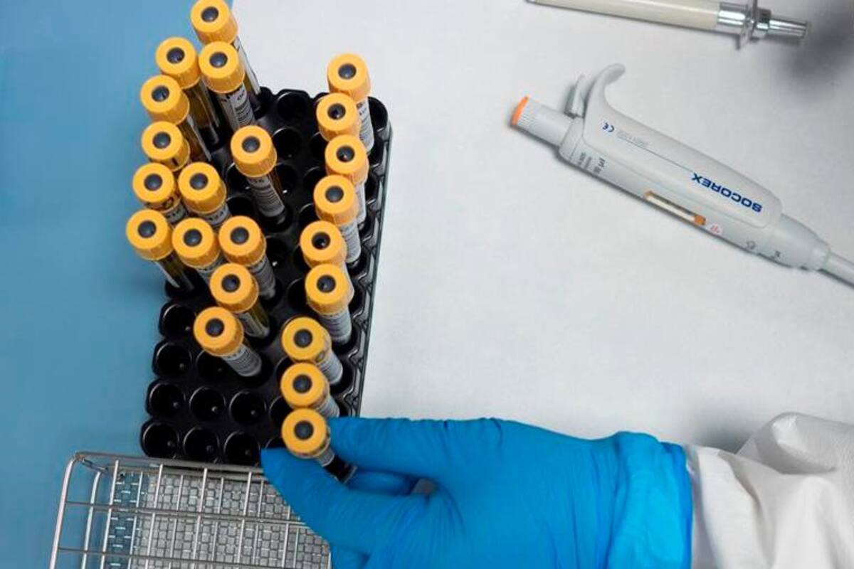 Análisis de sangre indicaría qué enfermos de Covid-19 pueden empeorar