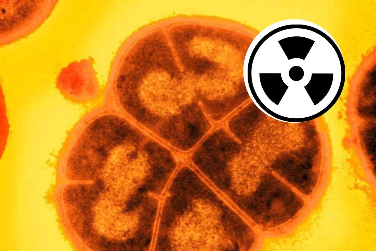 Conan, conoce la bacteria que puede aguantar la radiación extrema
