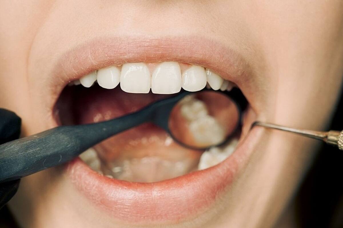 El 30% de la población mundial padece mal aliento; descubre la razón