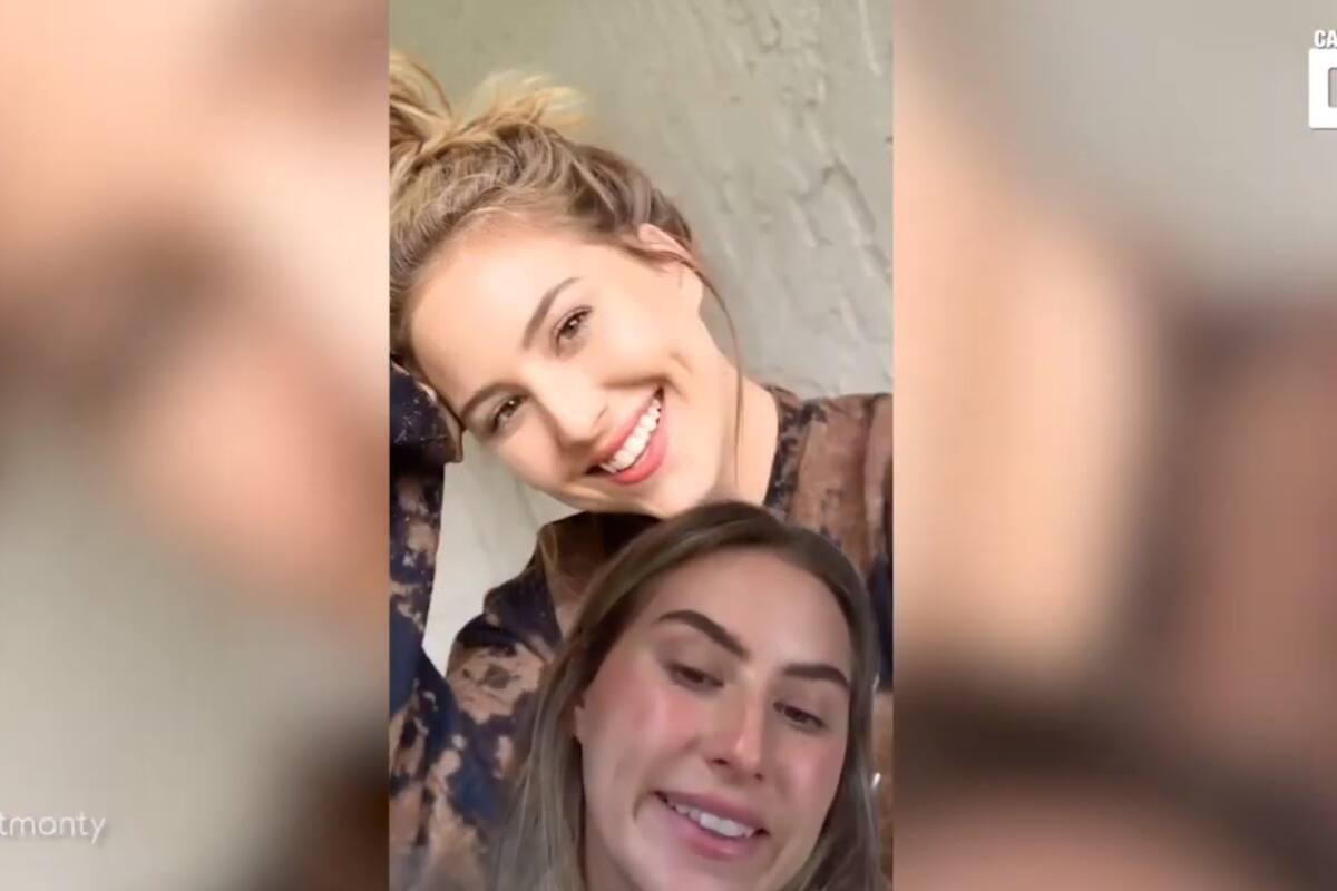 Esta mujer confiesa que el bótox arruinó su sonrisa