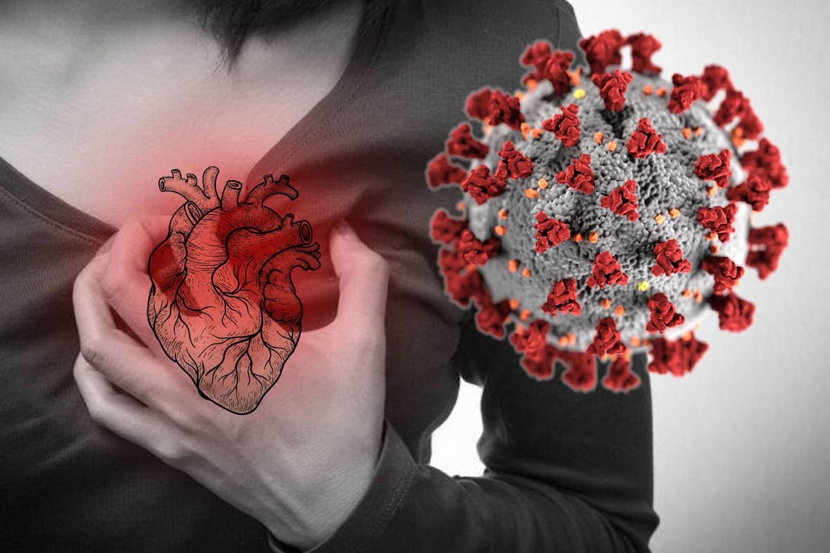 Covid-19 y gripe aumentan hasta 3 VECES más el riesgo de infarto y ataques cerebrovasculares incluso a un año del contagio