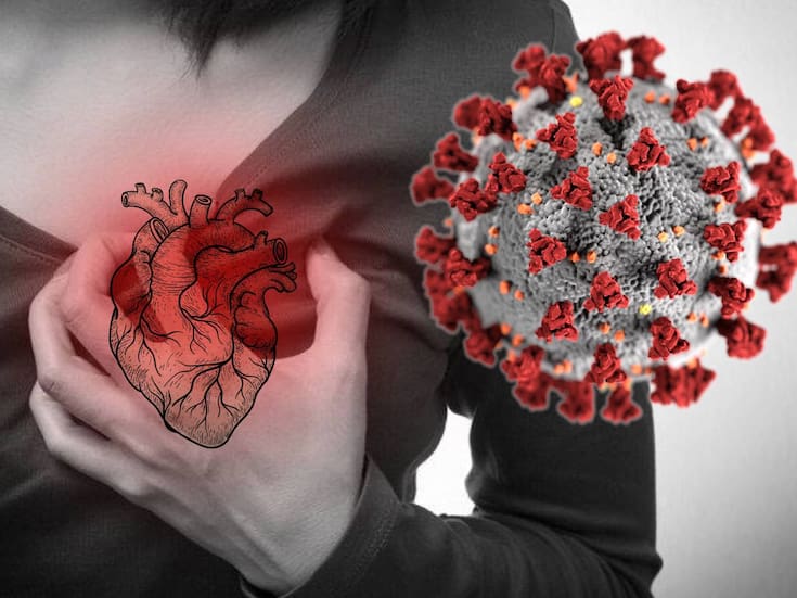 Covid-19 y gripe aumentan hasta 3 VECES más el riesgo de infarto y ataques cerebrovasculares incluso a un año del contagio
