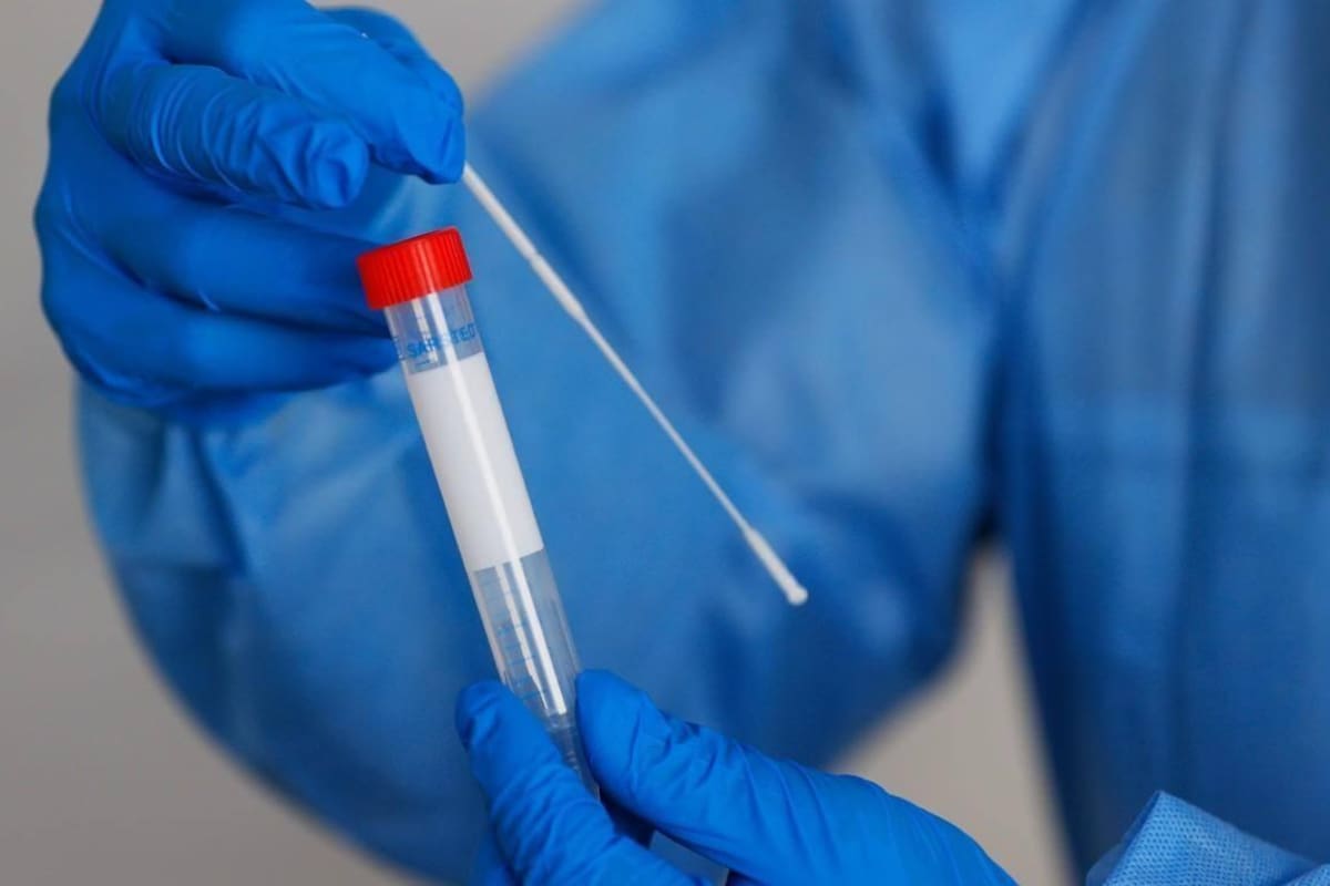 Algunas variantes del SARS-CoV-2 son resistentes a anticuerpos neutralizantes: Estudio
