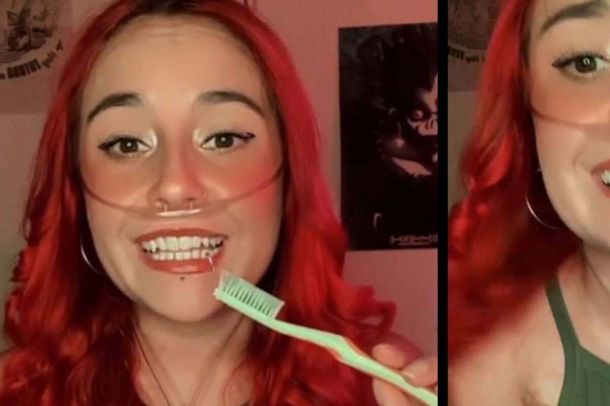 TikTok: Mujer cuenta cómo tuvo que asistir a clases para aprender a masticar y comer